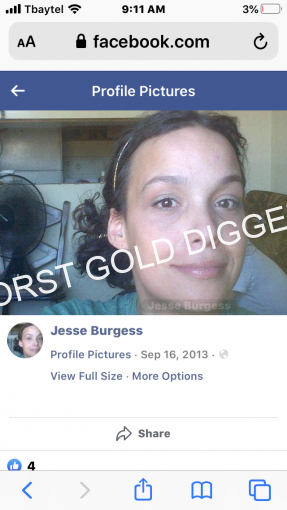 Jesse Burgess Fetus Drug Abuser